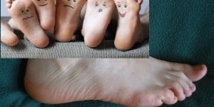 Röntgende belli olmuyor: En çok ayakta görülüyor