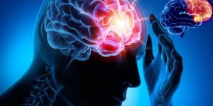 Epilepsi (sara) hastalığı nedir ? Nöbet sırasında ne yapılmalıdır.