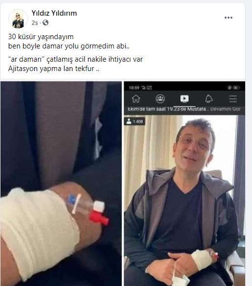 alay.jpg